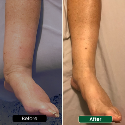 Lymphatic Support Drops