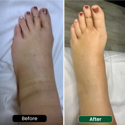 Lymphatic Support Drops